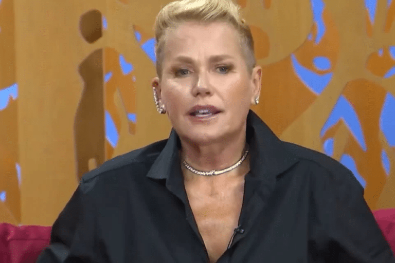 Xuxa Meneghel Revela Que Ficou Traumatizada Ap S Cirurgia No Nariz