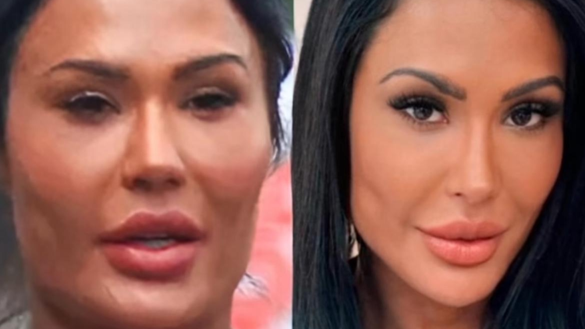 Foto de antes e depois das mudanças faciais de Gracyanne Barbosa