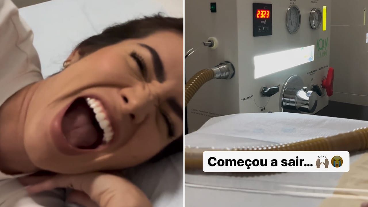 Montagem com fotos de Adriana Sant’Anna durante procedimento de limpeza do intestino grosso